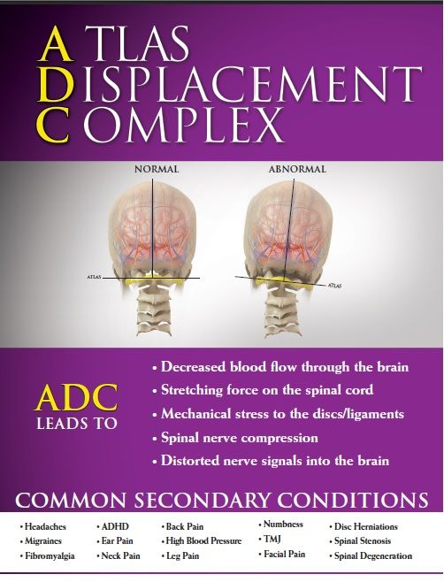 ADC Upper Cervical Chiropractic in Vermont