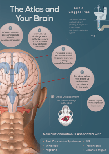 Reltationship between the Brain and Atlas and its affects on Inflammation and Neuro Degeneration in Migraines and Concussion