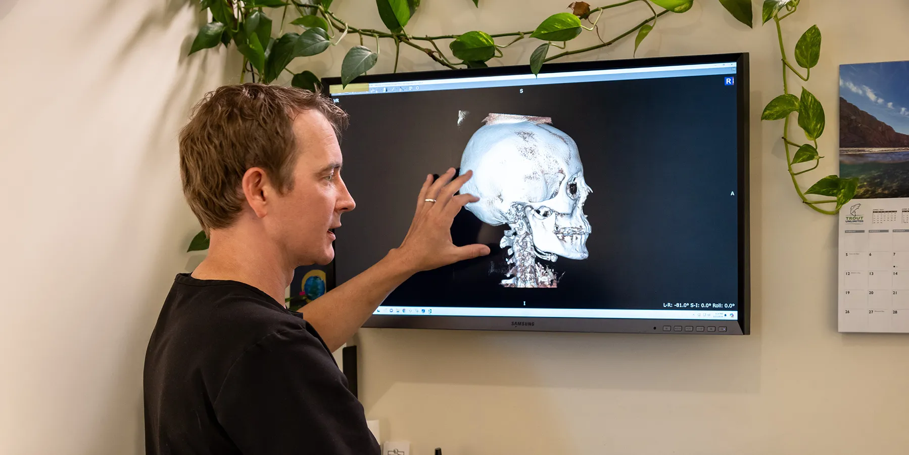 dr mccanse reviewing cone beam ct scan upper cervical chiropractic precision vermont