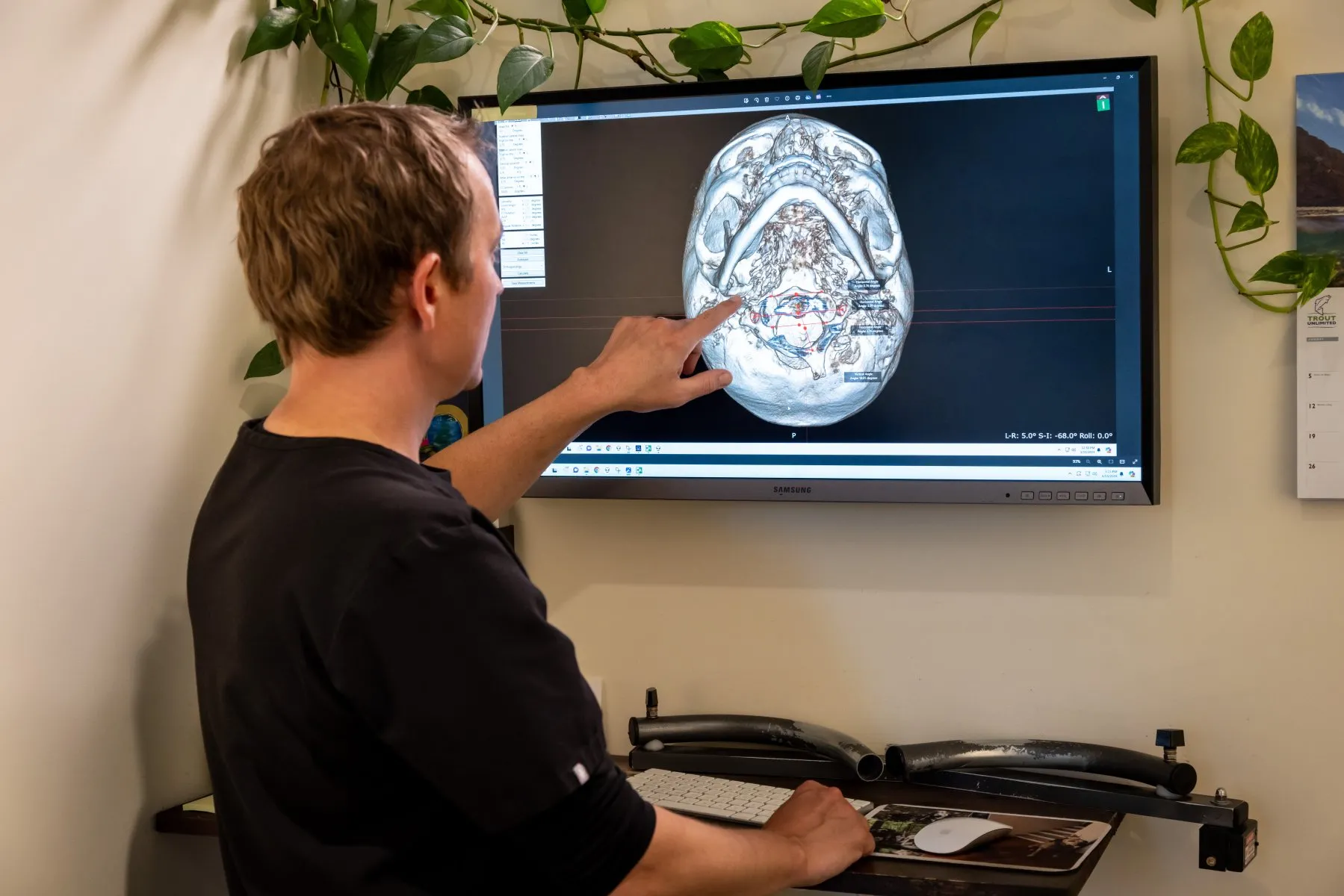 Dr. McCanse, Upper Cervical chiropractor reviewing axial CBCT scan to assess atlas and axis misalignment during diagnosis at Precision Chiropractic in Vermont