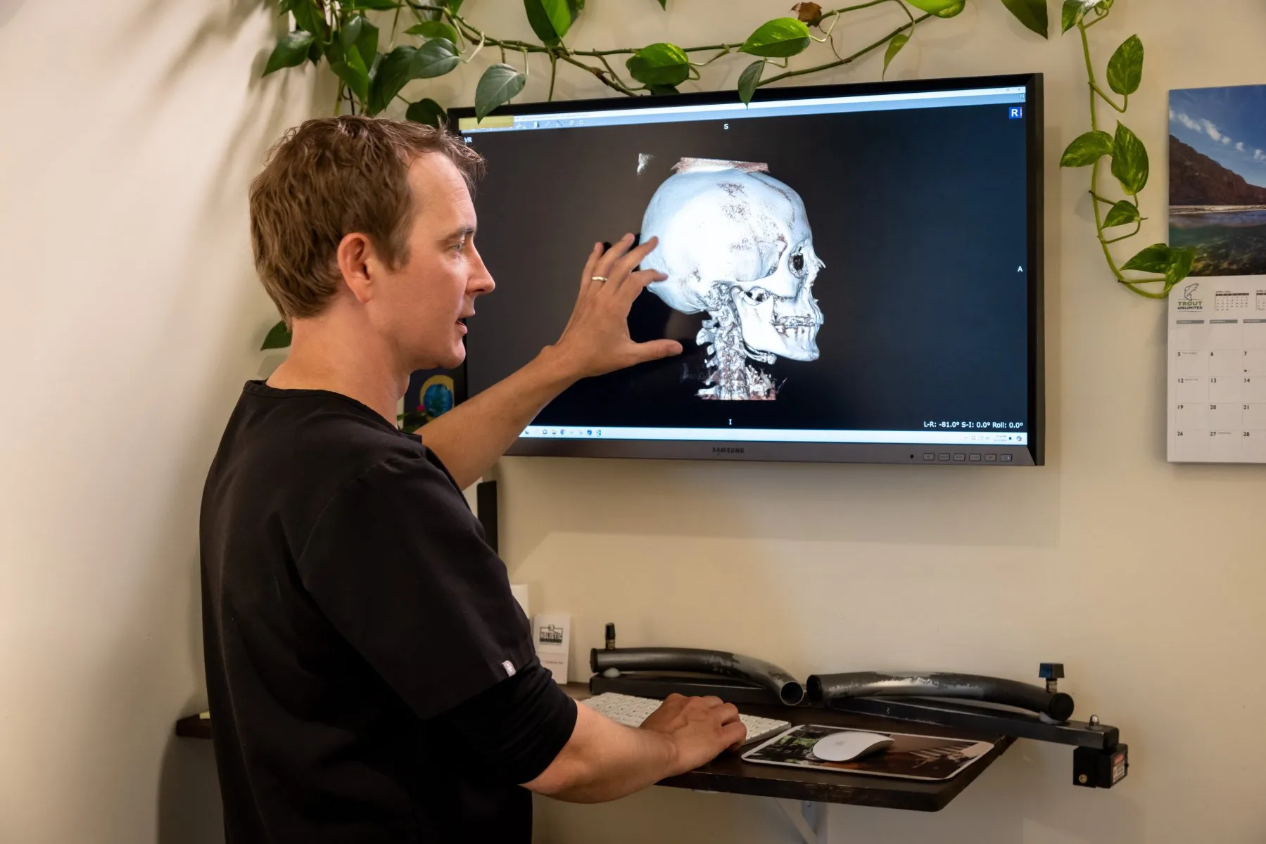 Dr. McCanse reviewing 3D Cone Beam CT scan of upper cervical spine on screen at Precision Chiropractic in Vermont.